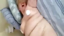 Tattoo zerstören ein ...